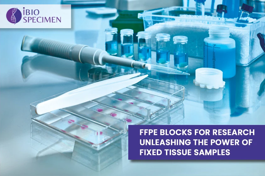Fixed Tissue Samples