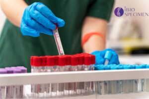 Exploring Human FFPE Tissue Samples and Biospecimens in the USA