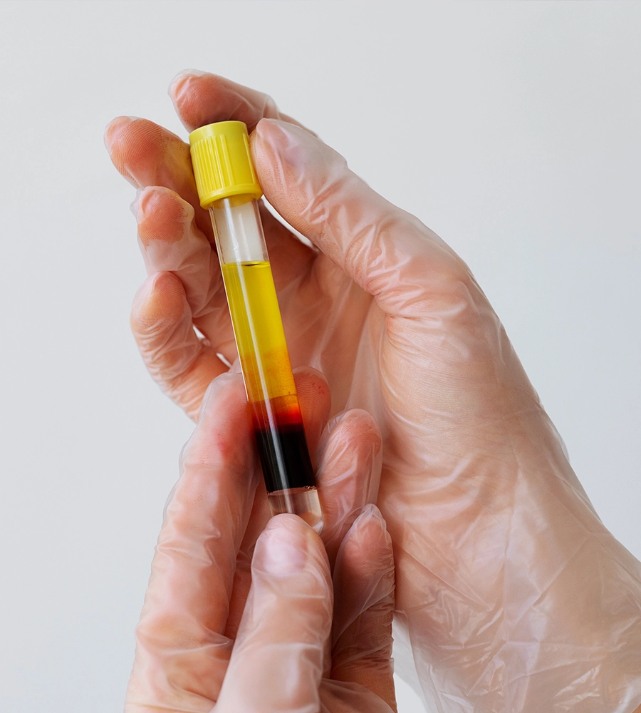 Human Serum & Plasma Samples