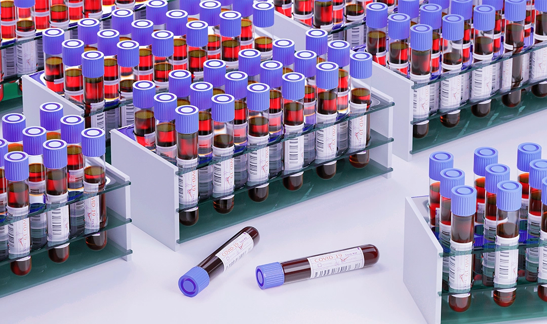 Remnant Serum from 200 Patients