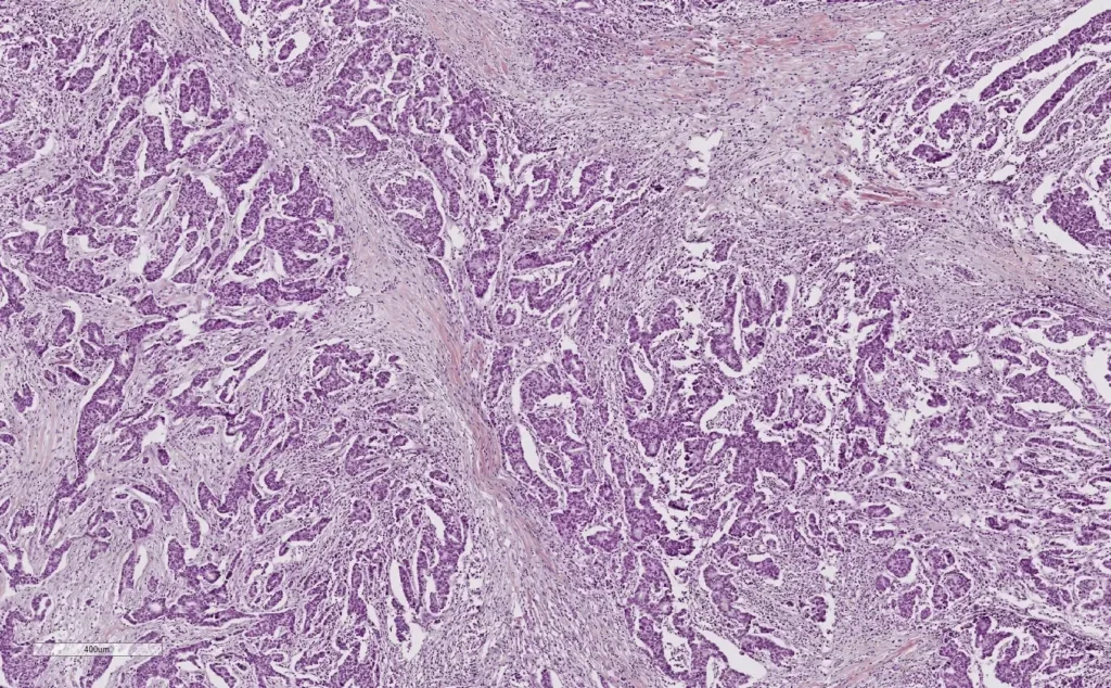 Fresh vs Frozen Tissue Samples