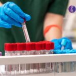 Human FFPE Tissue Samples