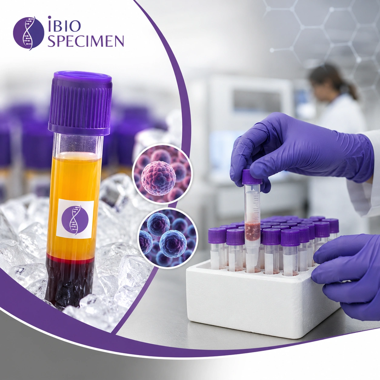 Banked-Plasma-PBMCs-For-Early-Stage-Cancer