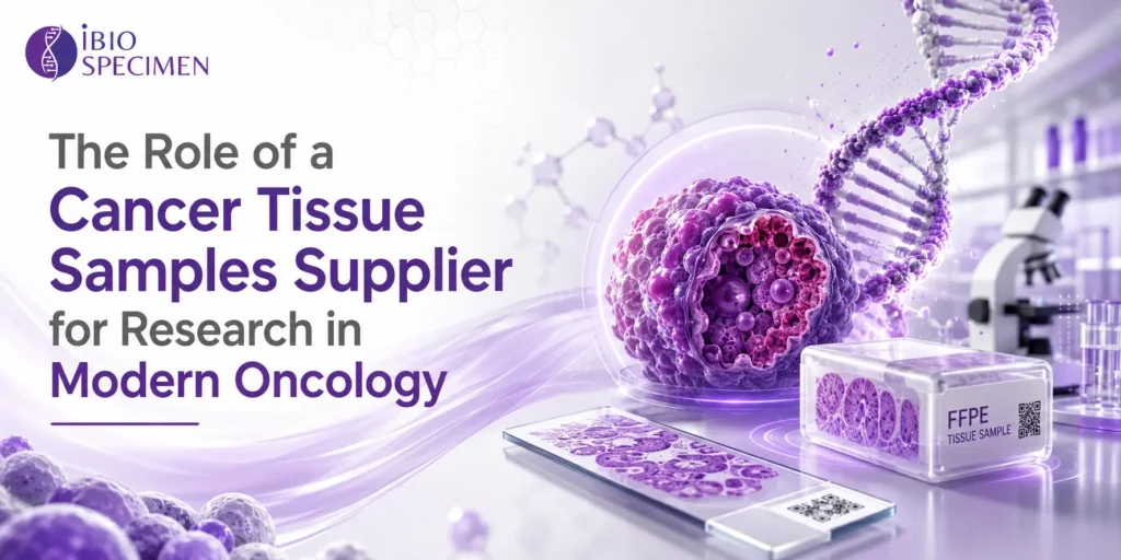Cancer Tissue
